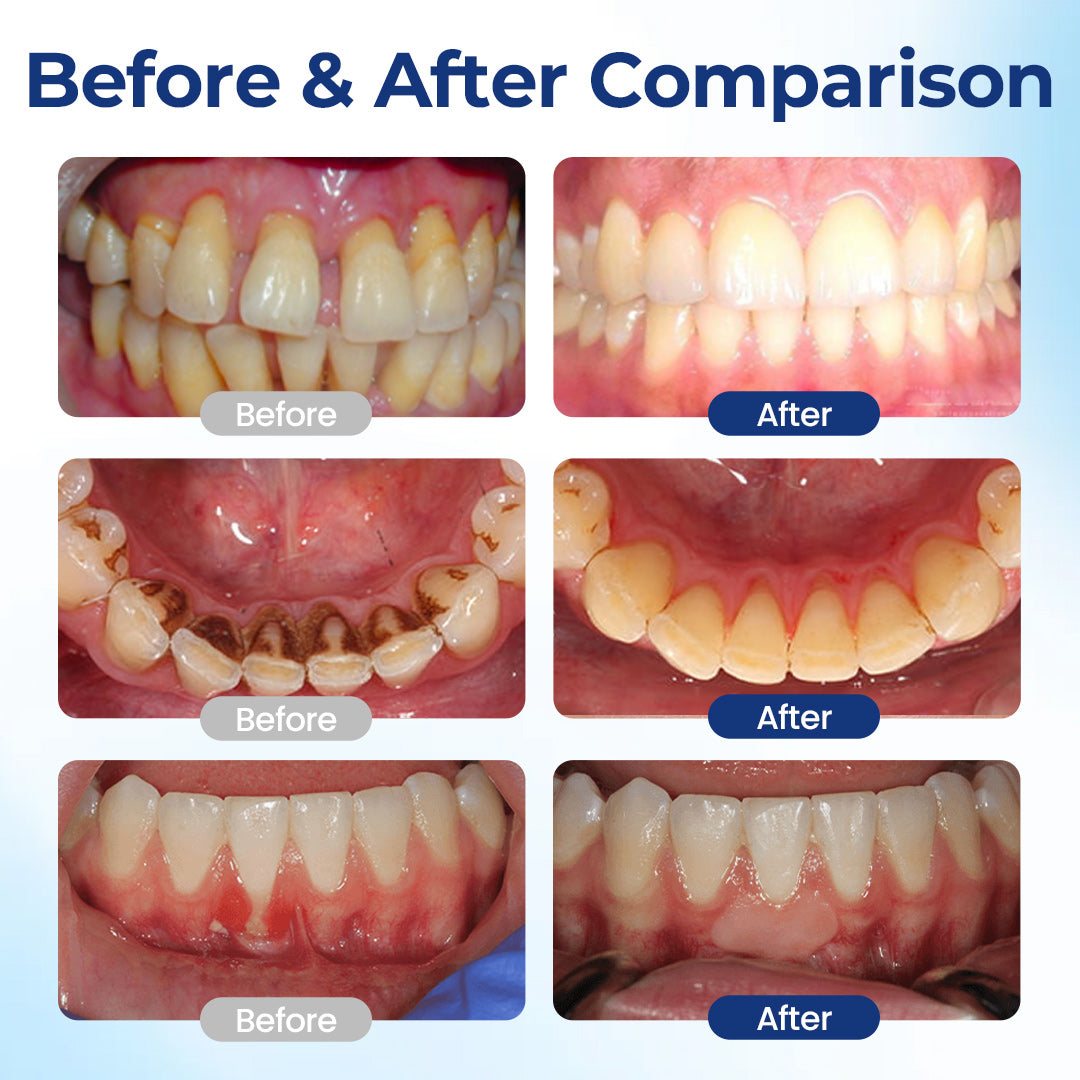 🔥Pryxo™ BeeTakt Oral Repair Solution🔥