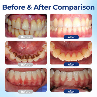 🔥Pryxo™ BeeTakt Oral Repair Solution🔥
