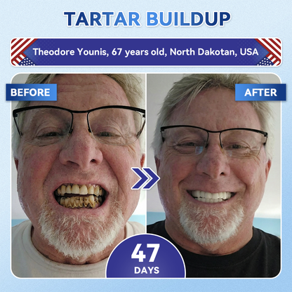 Pryxo™ 🦷 Tideglusib Fast‑Dissolving Tooth & Gum Repair Oral Strips ✨