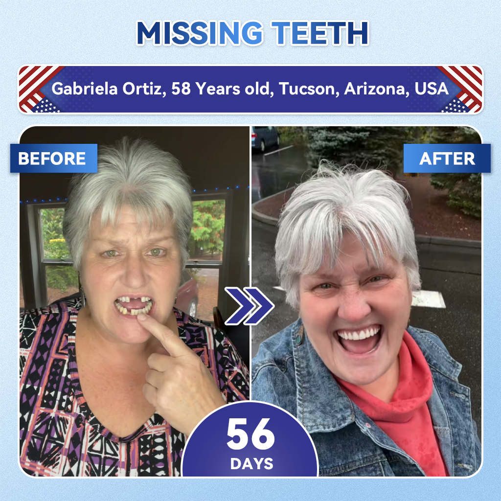 Pryxo™ 🦷 Tideglusib Fast‑Dissolving Tooth & Gum Repair Oral Strips ✨