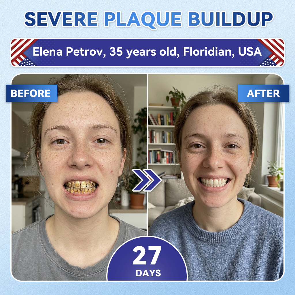 Pryxo™ 🦷 Tideglusib Fast‑Dissolving Tooth & Gum Repair Oral Strips ✨