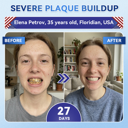 Pryxo™ 🦷 Tideglusib Fast‑Dissolving Tooth & Gum Repair Oral Strips ✨