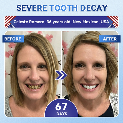 Pryxo™ 🦷 Tideglusib Fast‑Dissolving Tooth & Gum Repair Oral Strips ✨