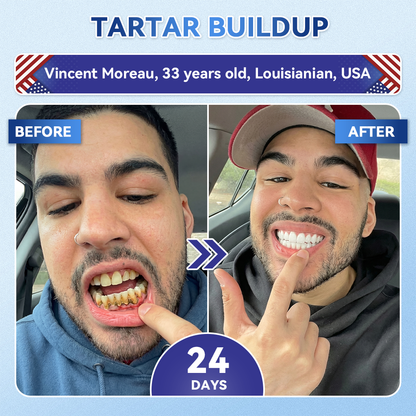 Pryxo™ 🦷 Tideglusib Fast‑Dissolving Tooth & Gum Repair Oral Strips ✨