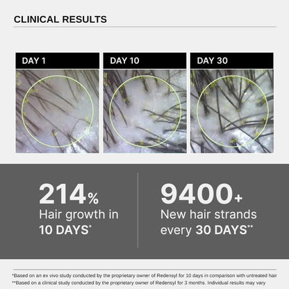 🔥Final 4 Hours: 33% OFF : Hair Growth Serum | Scalp Nourishing Oil for Thicker, Fuller & Healthier Hair Growth