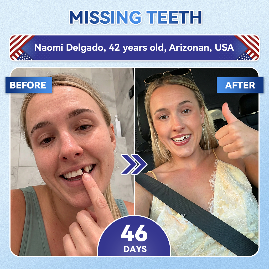 Pryxo™ 🦷 Tideglusib Fast‑Dissolving Tooth & Gum Repair Oral Strips ✨