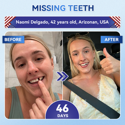 Pryxo™ 🦷 Tideglusib Fast‑Dissolving Tooth & Gum Repair Oral Strips ✨