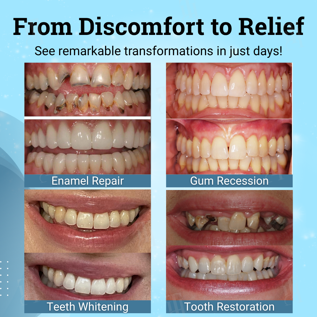 👨‍⚕️ Dentist's Choice : Pryxo™ Non-Surgical Gum "Suture" Gel