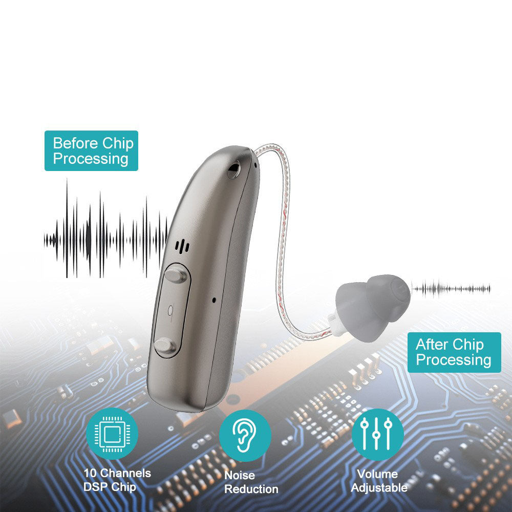 🔥Sonalese™ Smart   Sound Support – Hear   Clearly Again | 60% OFF