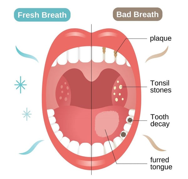 Pryxo™ 40+ Gum Repair Toothpaste