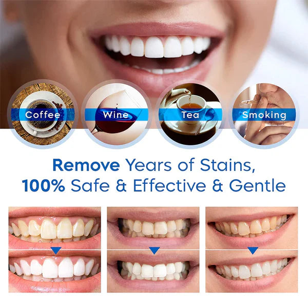 Pryxo™ Teeth Whitening Essence